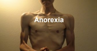 Home Remedies for Anorexia