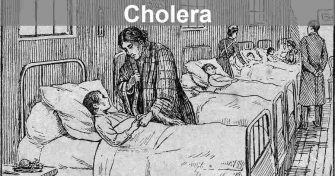 Home Remedies for Cholera