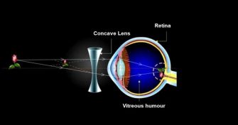 Home Remedies for Defective Vision