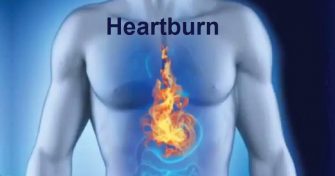 Home Remedies for Heartburn