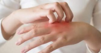 Home Remedies for Itching