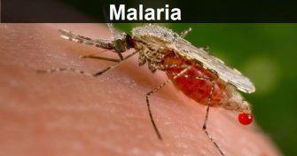 Home Remedies for Malaria