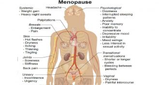 Home Remedies for Menopausal Disorder
