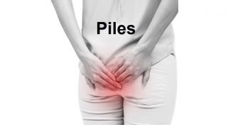 Home Remedies for Piles