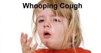 Home Remedies for Whooping Cough